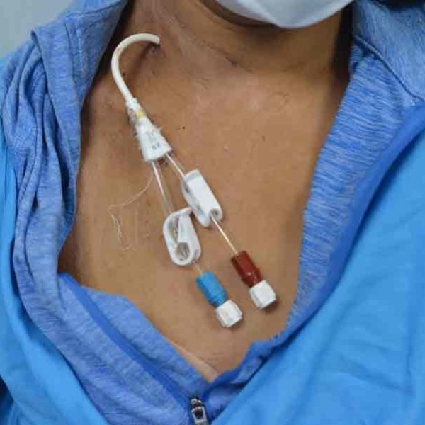 Para Carla asistir a las hemodiálisis le ayuda a convivir y a fortalecerse con otros pacientes renales que llegan a un clínica privada en San Miguel. Foto EDH/ Yessica Hompanera