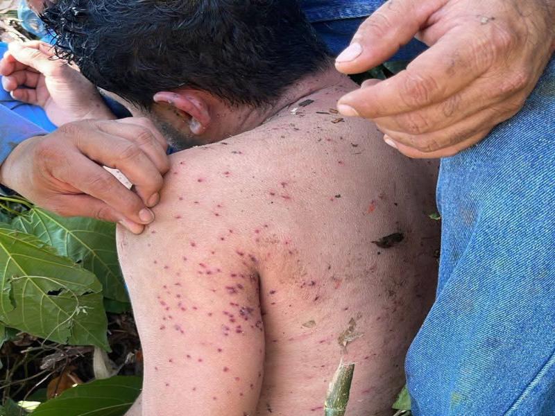 Hombre atacado por abejas