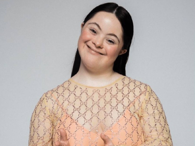 Ellie Goldstein, una modelo con síndrome de Down, fue estrella de la nueva campaña de Gucci. Foto EDH/ Instagram @elliejg16_zebedeemodel