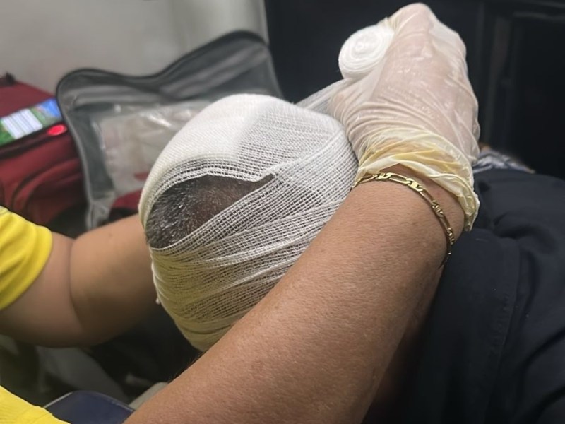 Una persona es atendida por un miembro de Comandos de Salvamento tras resultar con quemaduras en su cabeza. Foto EDH/Cortesía